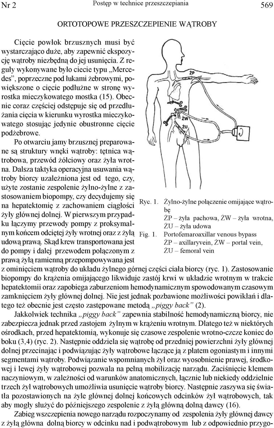 Obecnie coraz czêœciej odstêpuje siê od przed³u- ania ciêcia w kierunku wyrostka mieczykowatego stosuj¹c jedynie obustronne ciêcie pod ebrowe.