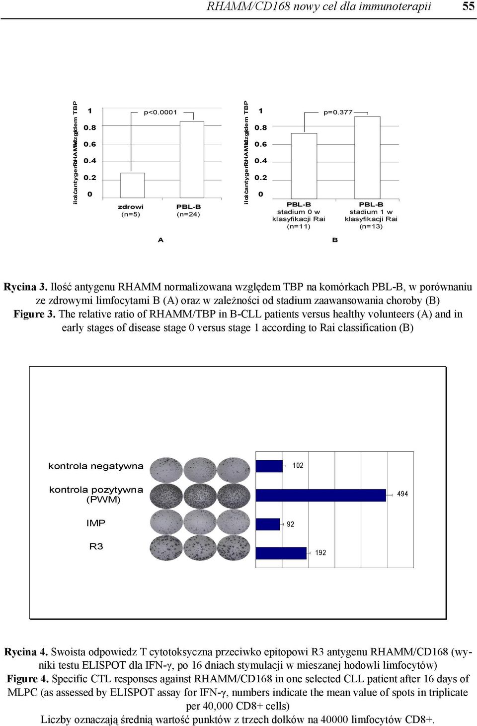 Ilość antygenu RHAMM normalizowana względem TBP na komórkach PBL-B, w porównaniu ze zdrowymi limfocytami B (A) oraz w zależności od stadium zaawansowania choroby (B) Figure 3.