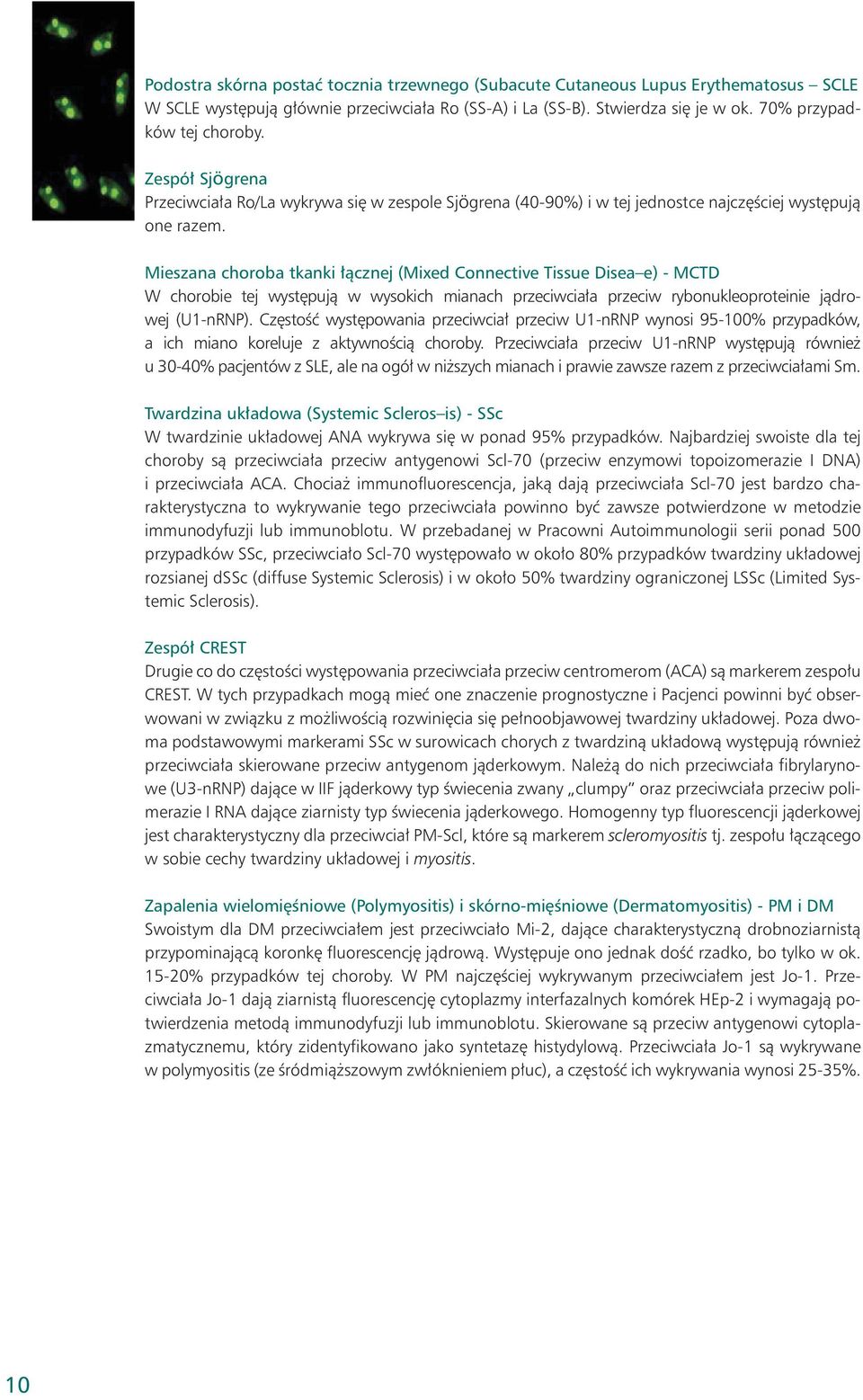 Mieszana choroba tkanki łącznej (Mixed Connective Tissue Disea e) - MCTD W chorobie tej występują w wysokich mianach przeciwciała przeciw rybonukleoproteinie jądrowej (U1-nRNP).