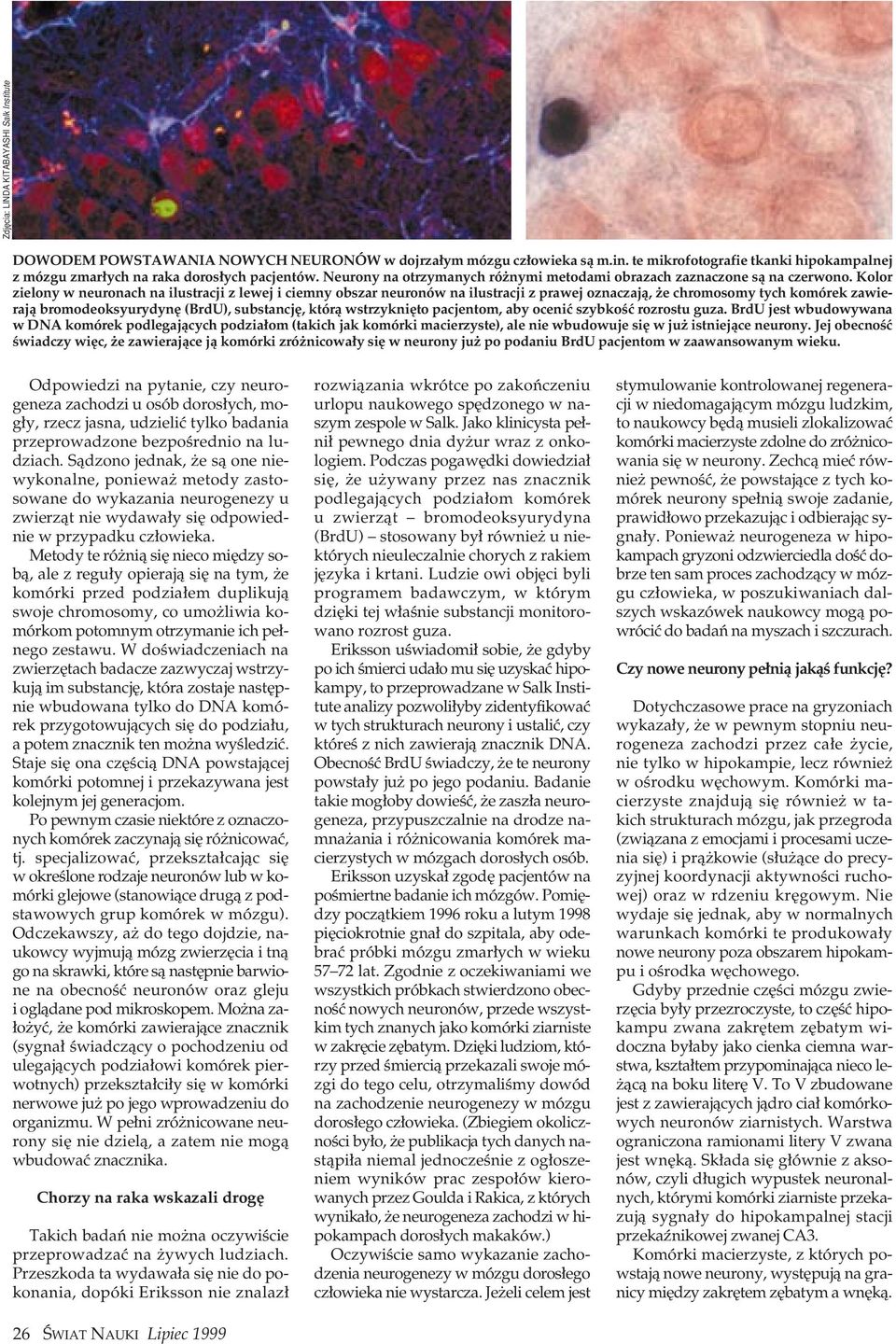 Kolor zielony w neuronach na ilustracji z lewej i ciemny obszar neuronów na ilustracji z prawej oznaczajà, e chromosomy tych komórek zawierajà bromodeoksyurydyn (BrdU), substancj, którà wstrzykni to