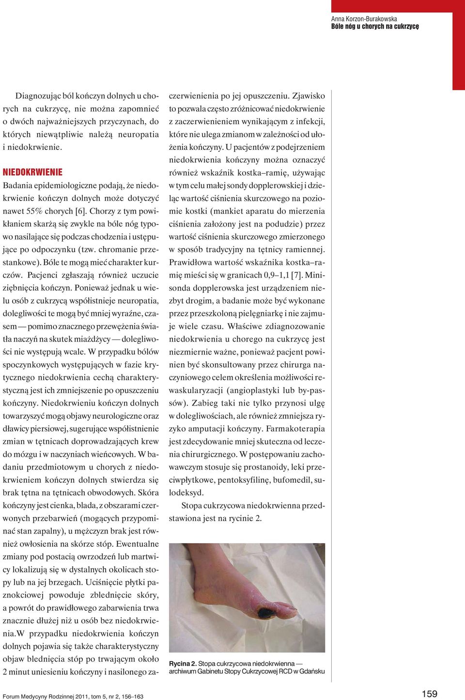 Chorzy z tym powikłaniem skarżą się zwykle na bóle nóg typowo nasilające się podczas chodzenia i ustępujące po odpoczynku (tzw. chromanie przestankowe). Bóle te mogą mieć charakter kurczów.