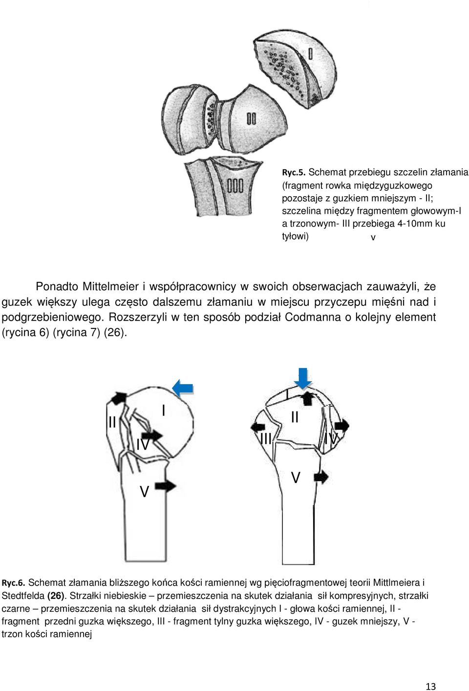 Mittelmeier i współpracownicy w swoich obserwacjach zauważyli, że guzek większy ulega często dalszemu złamaniu w miejscu przyczepu mięśni nad i podgrzebieniowego.