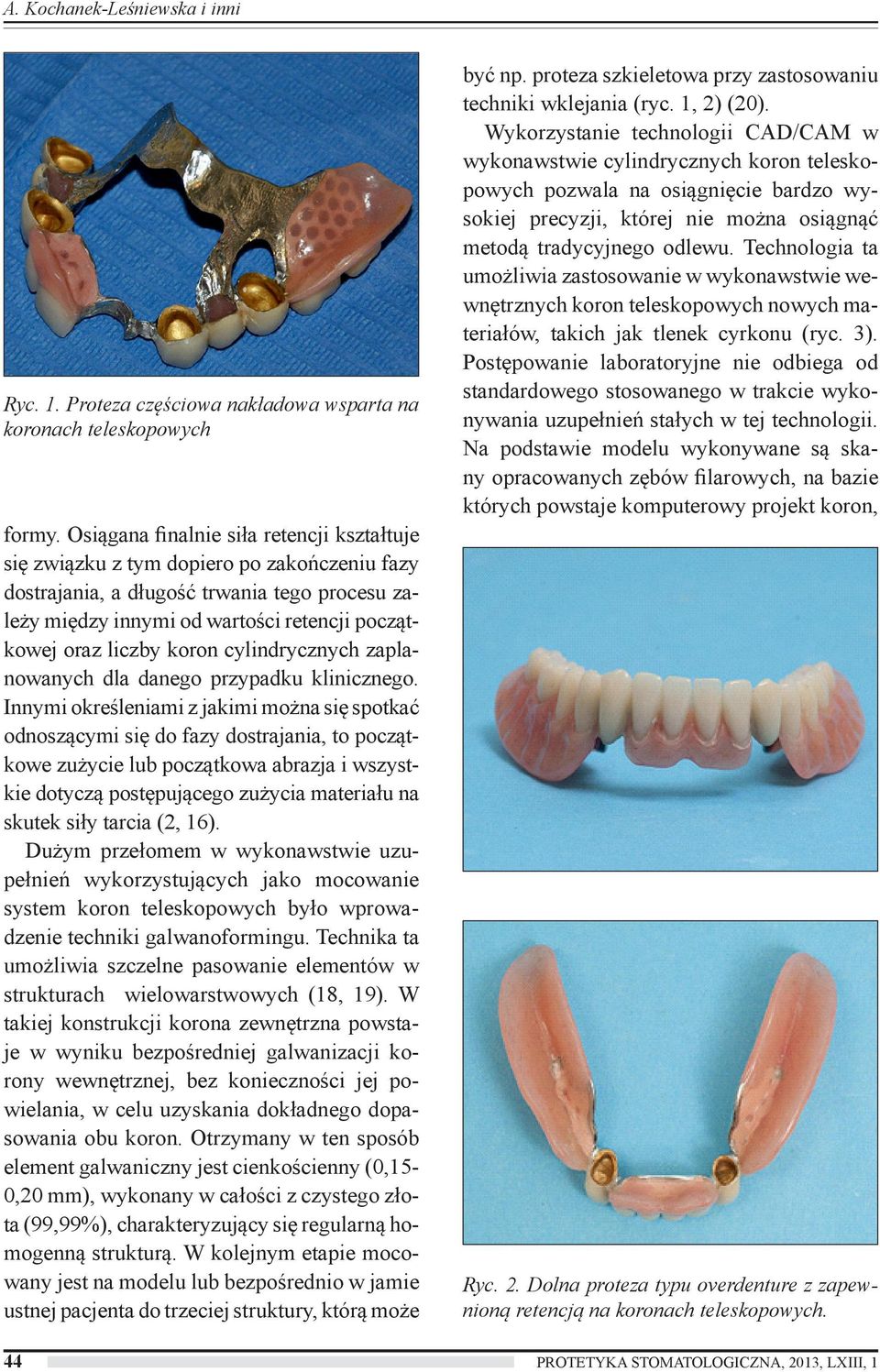 koron cylindrycznych zaplanowanych dla danego przypadku klinicznego.