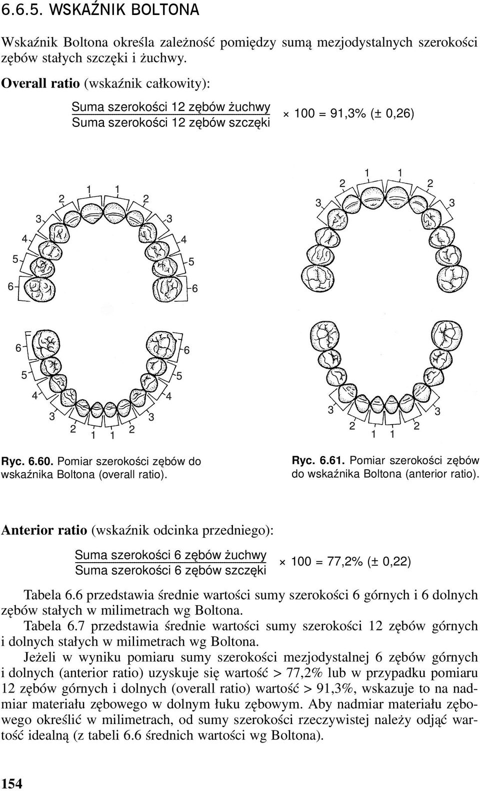 = 91,3% (± 0,26) Ryc. 6.60. Pomiar szerokości zębów do wskaźnika Boltona (overall ratio). Ryc. 6.61. Pomiar szerokości zębów do wskaźnika Boltona (anterior ratio).
