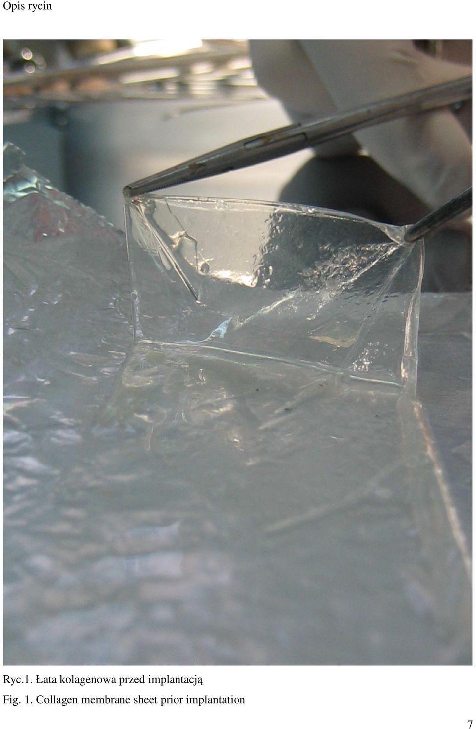 implantacją Fig. 1.