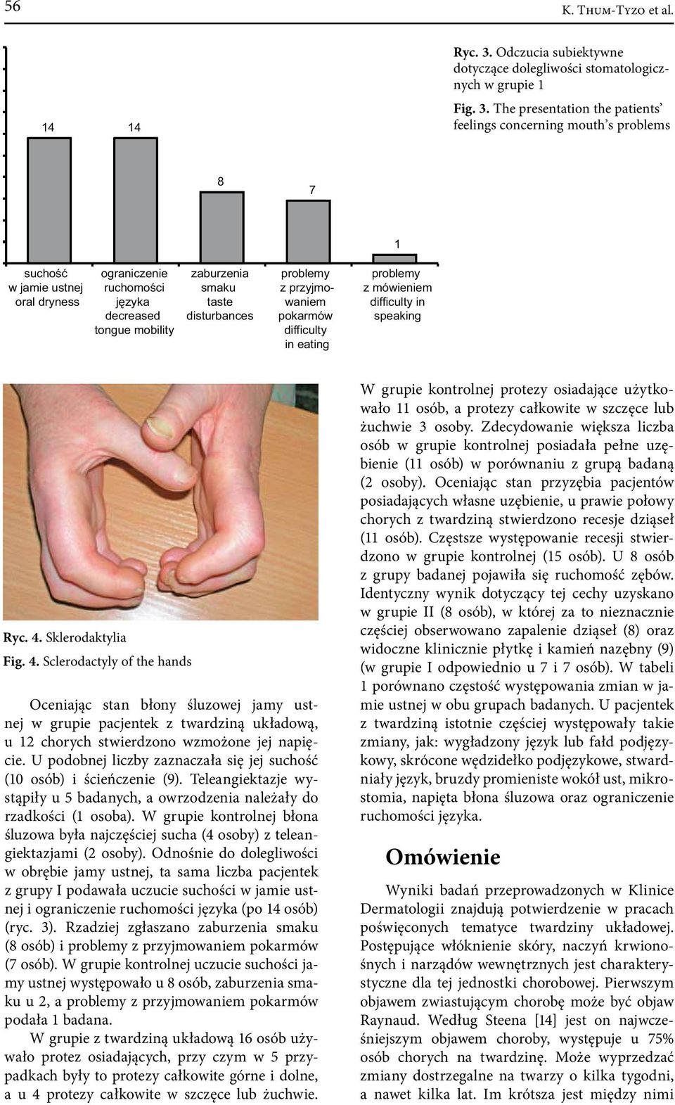 The presentation the patients feelings concerning mouth s problems 8 7 1 suchość w jamie ustnej oral dryness ograniczenie ruchomości języka decreased tongue mobility zaburzenia smaku taste