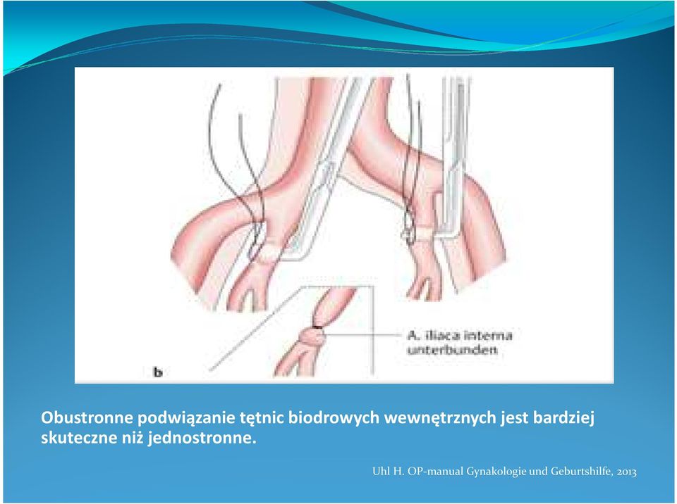 bardziej skuteczne niż jednostronne.