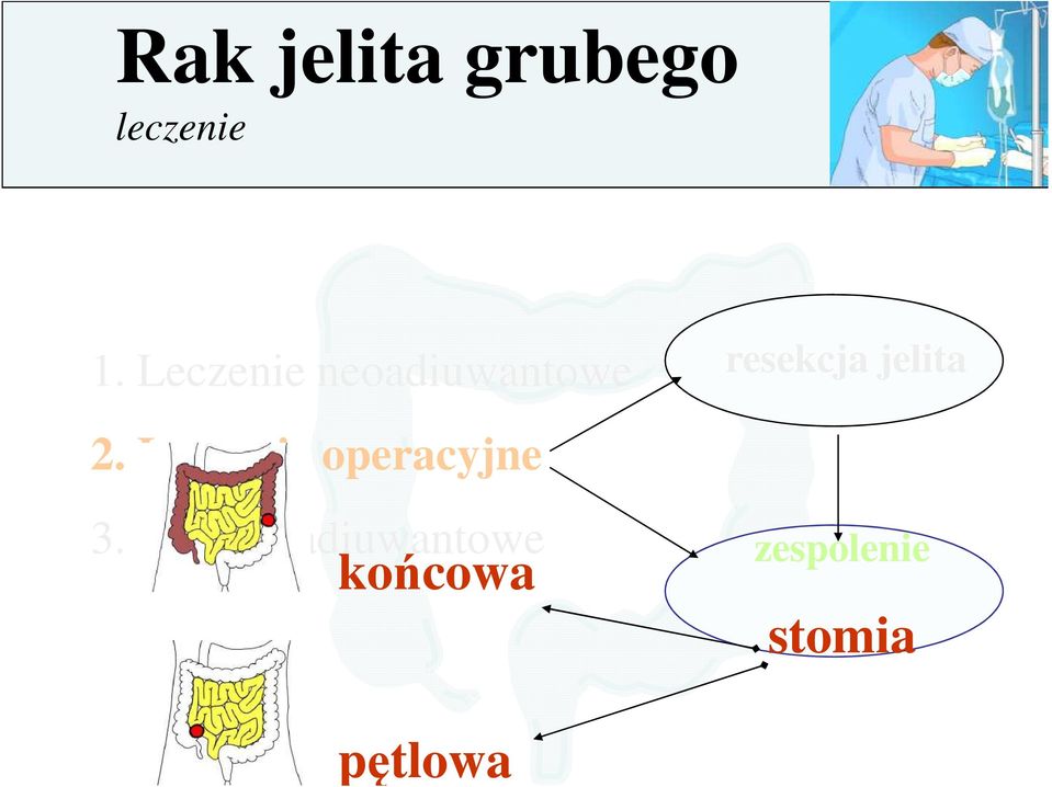 jelita 2. Leczenie operacyjne 3.