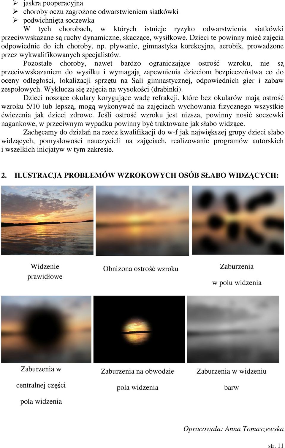 Pozostałe choroby, nawet bardzo ograniczające ostrość wzroku, nie są przeciwwskazaniem do wysiłku i wymagają zapewnienia dzieciom bezpieczeństwa co do oceny odległości, lokalizacji sprzętu na Sali