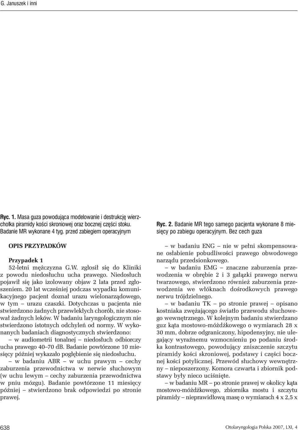 Niedosłuch pojawił się jako izolowany objaw 2 lata przed zgłoszeniem. 20 lat wcześniej podczas wypadku komunikacyjnego pacjent doznał urazu wielonarządowego, w tym urazu czaszki.