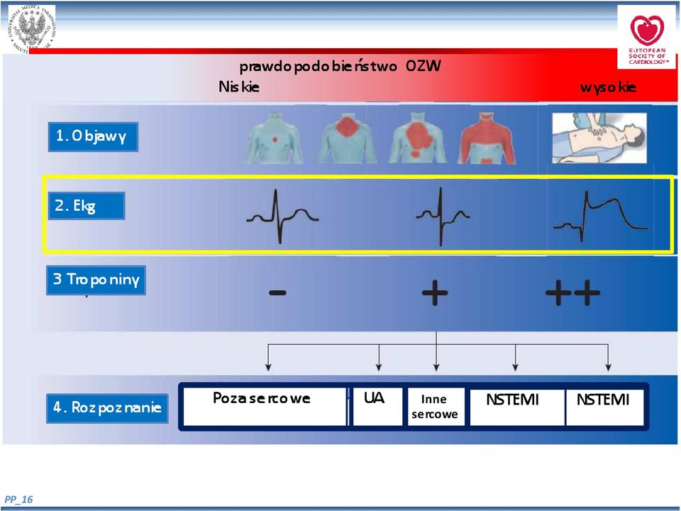 Ekg 3 Troponiny 4.