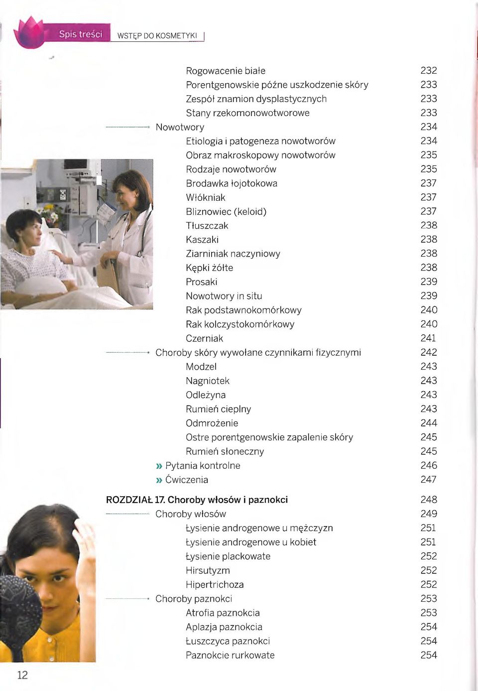kolczystokomórkowy Czerniak - Choroby skóry wywołane czynnikami fizycznymi Modzel Nagniotek Odleżyna Rumień cieplny Odmrożenie Ostre porentgenowskie zapalenie skóry Rumień słoneczny 232 233 233 233
