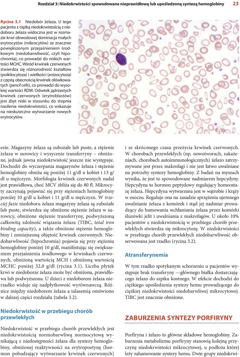 (niedobarwliwość, czyli hipochromia), co prowadzi do niskich wartości MCHC.