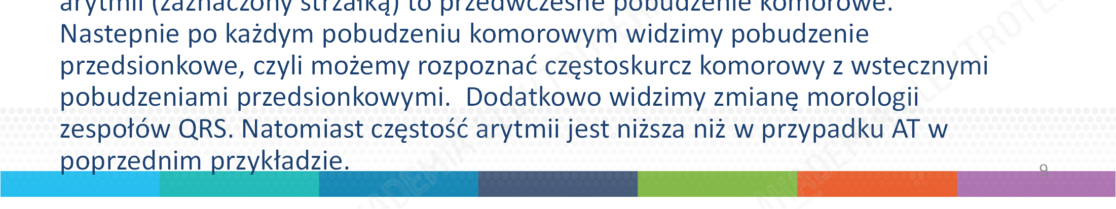 Nastepnie po każdym pobudzeniu komorowym widzimy pobudzenie przedsionkowe, czyli możemy rozpoznać częstoskurcz