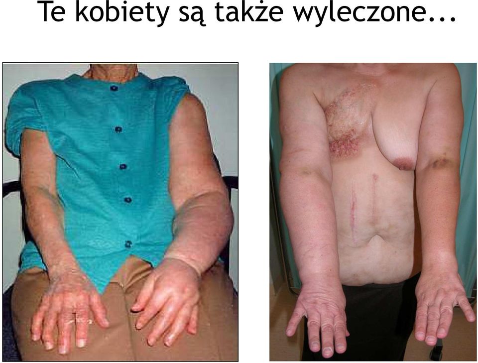 są także