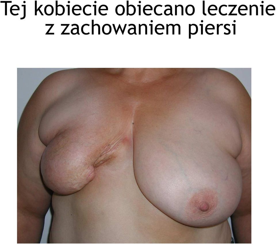 leczenie z