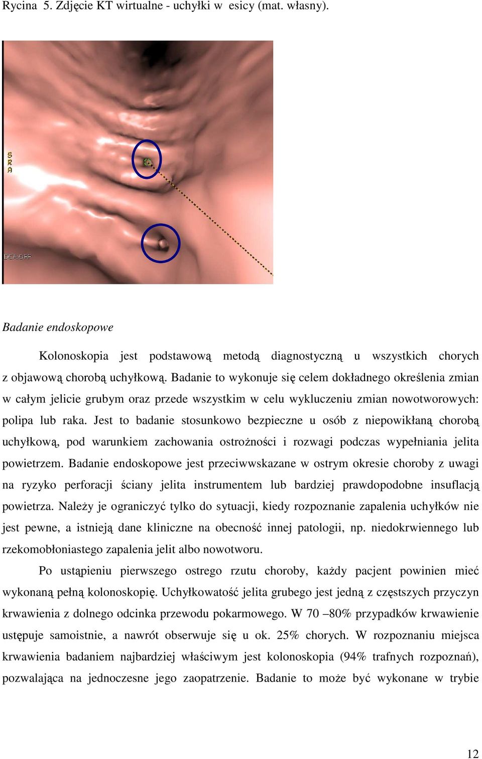 Jest to badanie stosunkowo bezpieczne u osób z niepowikłaną chorobą uchyłkową, pod warunkiem zachowania ostroŝności i rozwagi podczas wypełniania jelita powietrzem.
