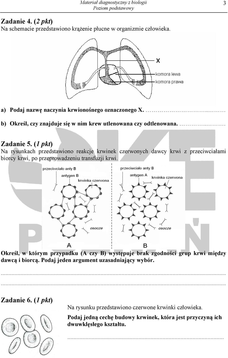 (1 pkt) Na rysunkach przedstawiono reakcje krwinek czerwonych dawcy krwi z przeciwciałami biorcy krwi, po przeprowadzeniu transfuzji krwi.