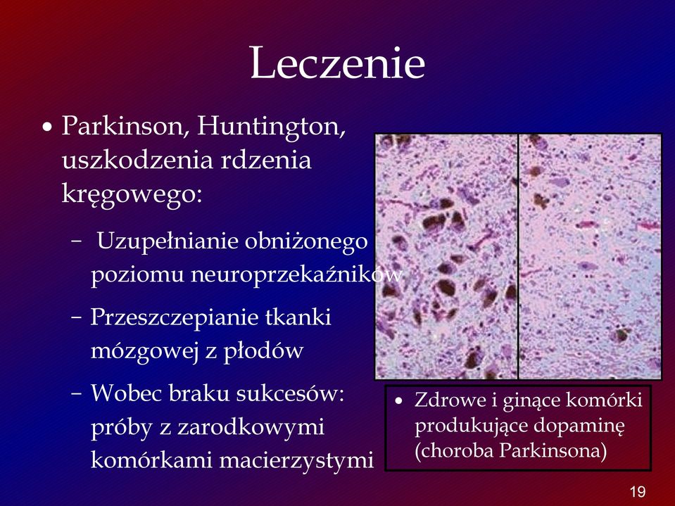 tkanki mózgowej z płodów Wobec braku sukcesów: próby z zarodkowymi