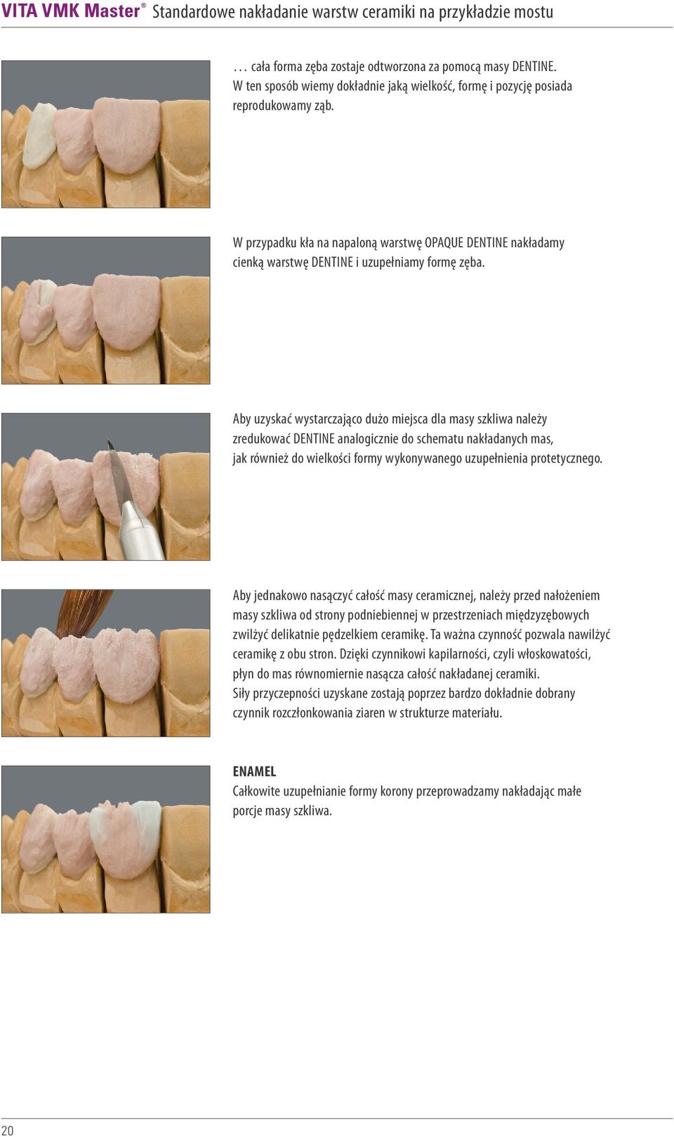 Aby uzyskać wystarczająco dużo miejsca dla masy szkliwa należy zredukować DENTINE analogicznie do schematu nakładanych mas, jak również do wielkości formy wykonywanego uzupełnienia protetycznego.