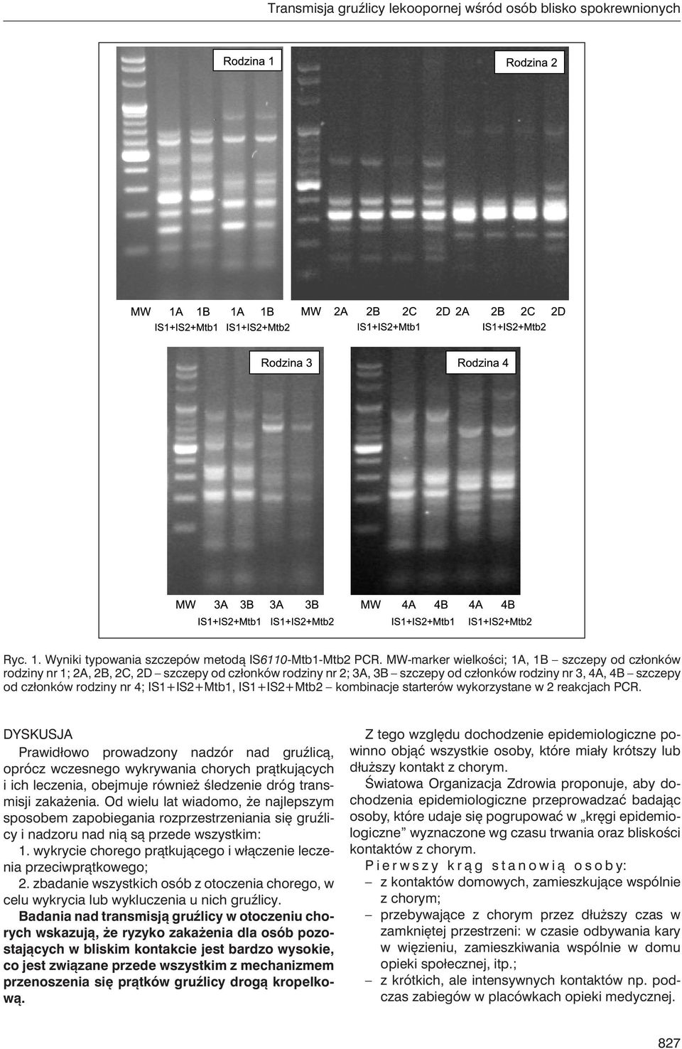 IS1+IS2+Mtb1, IS1+IS2+Mtb2 kombinacje starterów wykorzystane w 2 reakcjach PCR.
