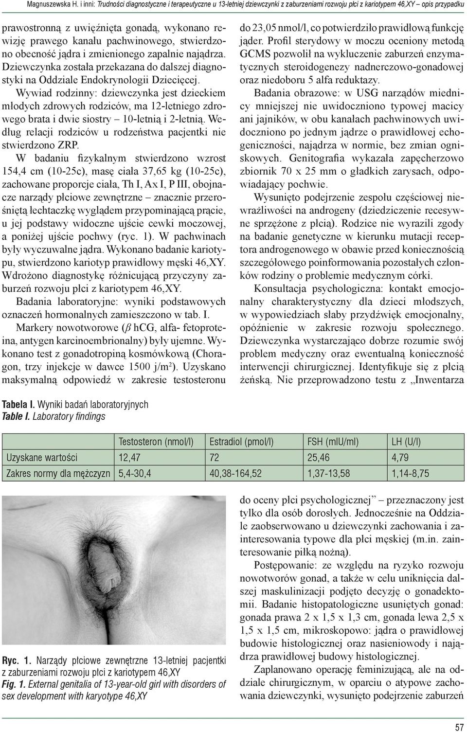 kanału pachwinowego, stwierdzono obecność jądra i zmienionego zapalnie najądrza. Dziewczynka została przekazana do dalszej diagnostyki na Oddziale Endokrynologii Dziecięcej.