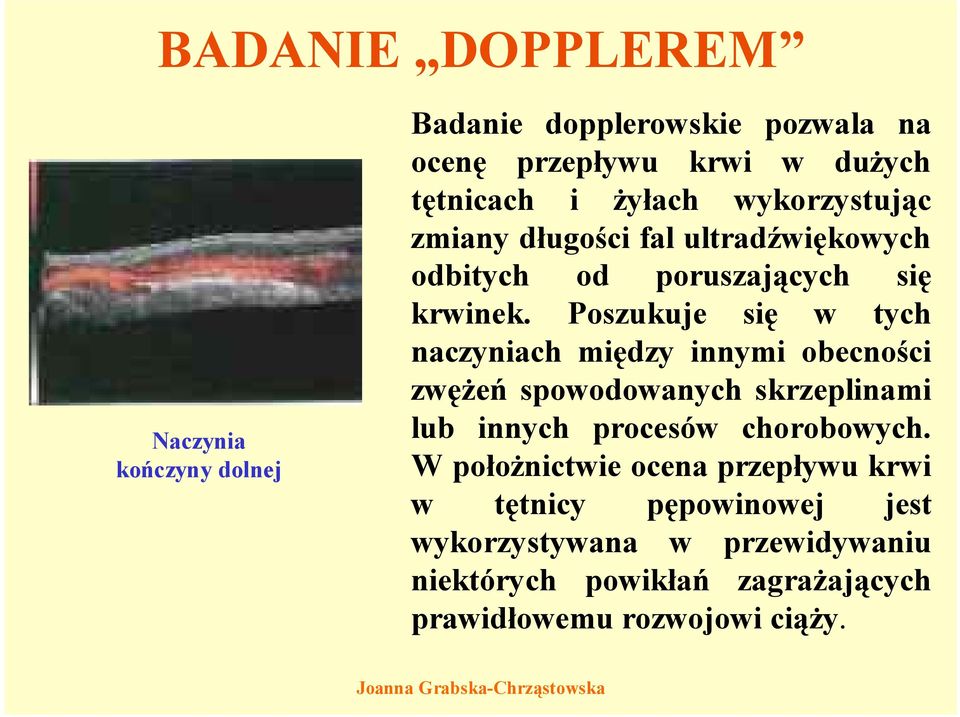 Poszukuje się w tych naczyniach między innymi obecności zwężeń spowodowanych skrzeplinami lub innych procesów chorobowych.