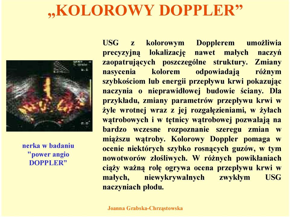 Dla przykładu, zmiany parametrów przepływu krwi w żyle wrotnej wraz z jej rozgałęzieniami, w żyłach wątrobowych i w tętnicy wątrobowej pozwalają na bardzo wczesne rozpoznanie szeregu