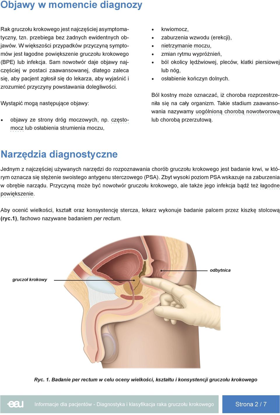 Sam nowotwór daje objawy najczęściej w postaci zaawansowanej, dlatego zaleca się, aby pacjent zgłosił się do lekarza, aby wyjaśnić i zrozumieć przyczyny powstawania dolegliwości.