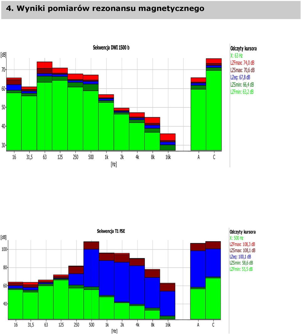 66,4 db LZFmin: 63,2 db 30 100 80 Sekwencja T1 FSE X: 500 Hz LZFmax: