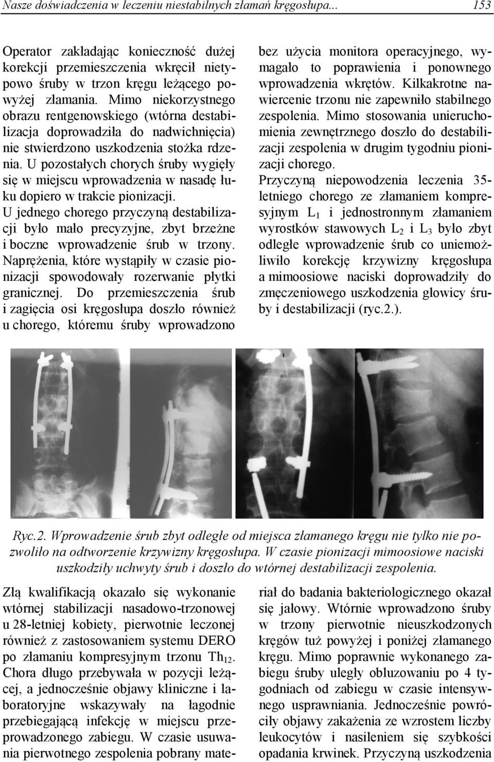 U pozostałych chorych śruby wygięły się w miejscu wprowadzenia w nasadę łuku dopiero w trakcie pionizacji.