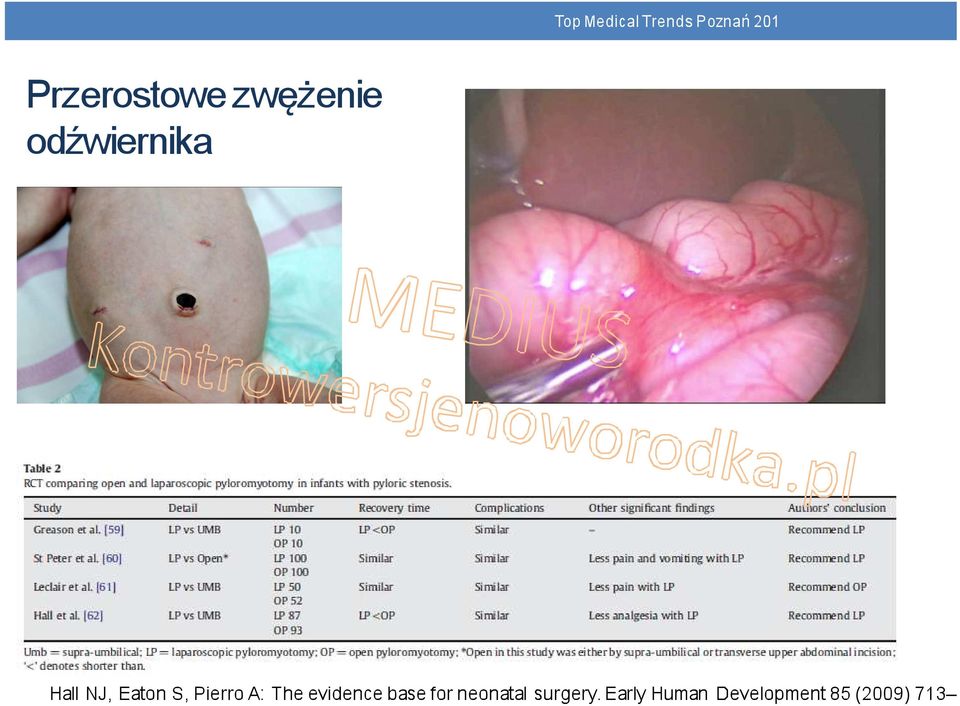 Pierro A: The evidence base for neonatal