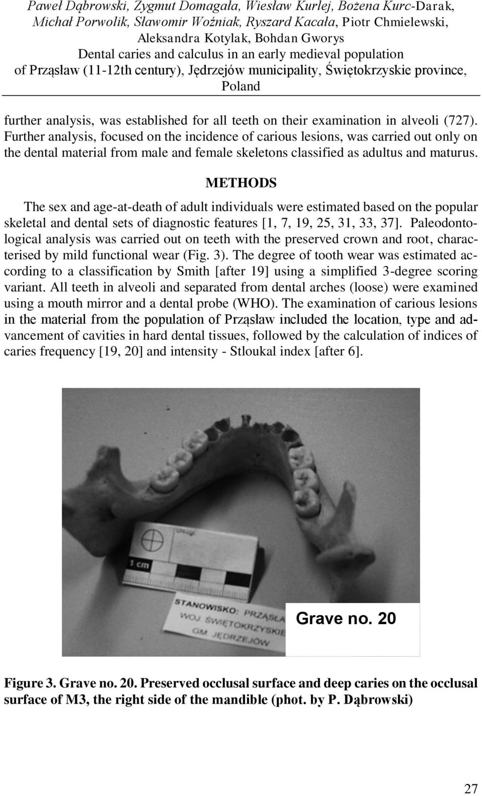 (727). Further analysis, focused on the incidence of carious lesions, was carried out only on the dental material from male and female skeletons classified as adultus and maturus.