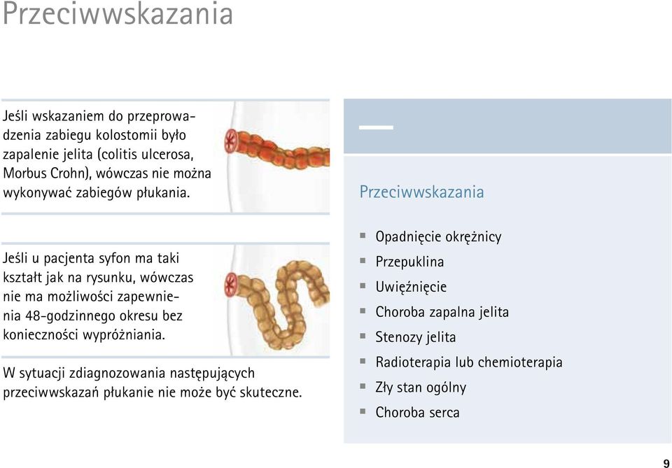 Jeśli u pacjenta syfon ma taki kształt jak na rysunku, wówczas nie ma możliwości zapewnienia 48-godzinnego okresu bez konieczności