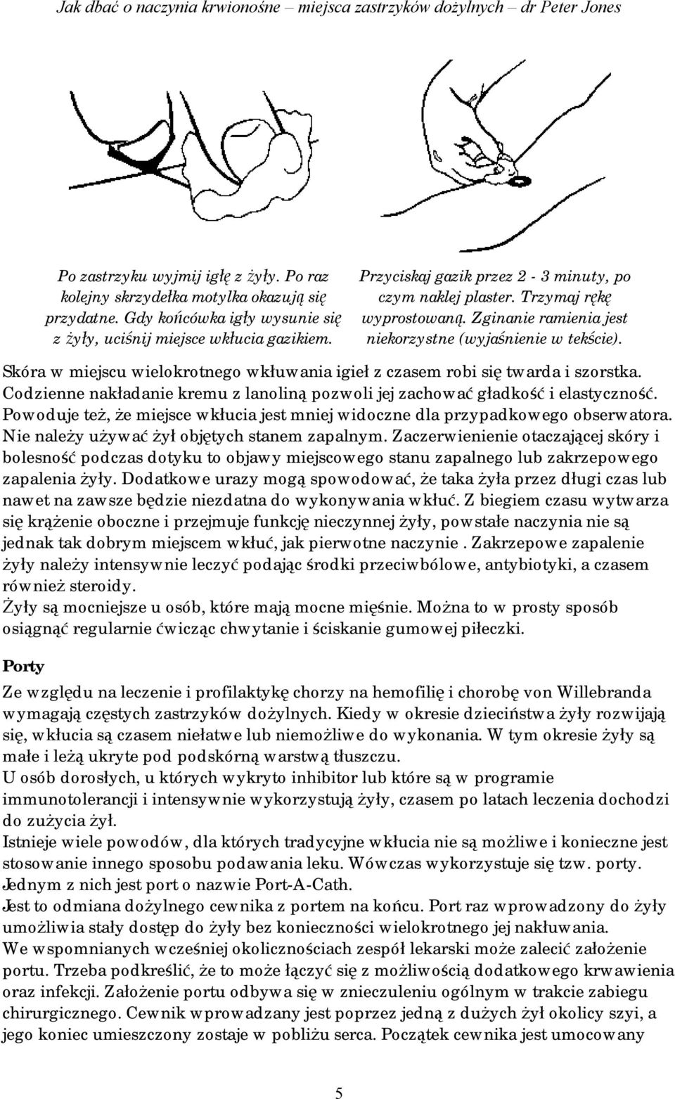 Skóra w miejscu wielokrotnego wkłuwania igieł z czasem robi się twarda i szorstka. Codzienne nakładanie kremu z lanoliną pozwoli jej zachować gładkość i elastyczność.
