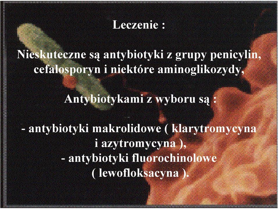wyboru są : - antybiotyki makrolidowe ( klarytromycyna i