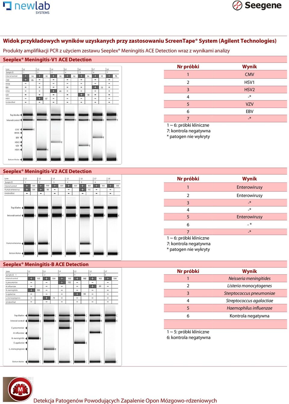 Meningitis-V2 Detection Enterowirusy 2 Enterowirusy 3 -* 4 -* 5 Enterowirusy 6 - * 7 -* ~ 6: próbki kliniczne 7: kontrola negatywna * patogen nie wykryty Seeplex