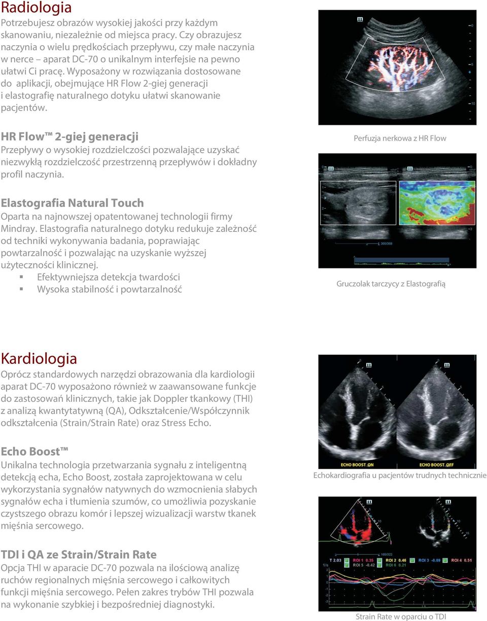 Wyposażony w rozwiązania dostosowane do aplikacji, obejmujące HR Flow 2-giej generacji i elastografię naturalnego dotyku ułatwi skanowanie pacjentów.