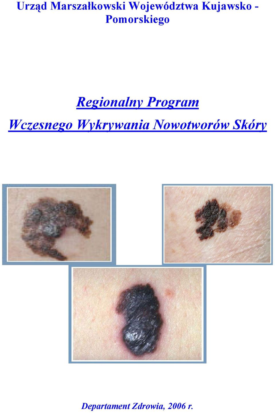 Program Wczesnego Wykrywania