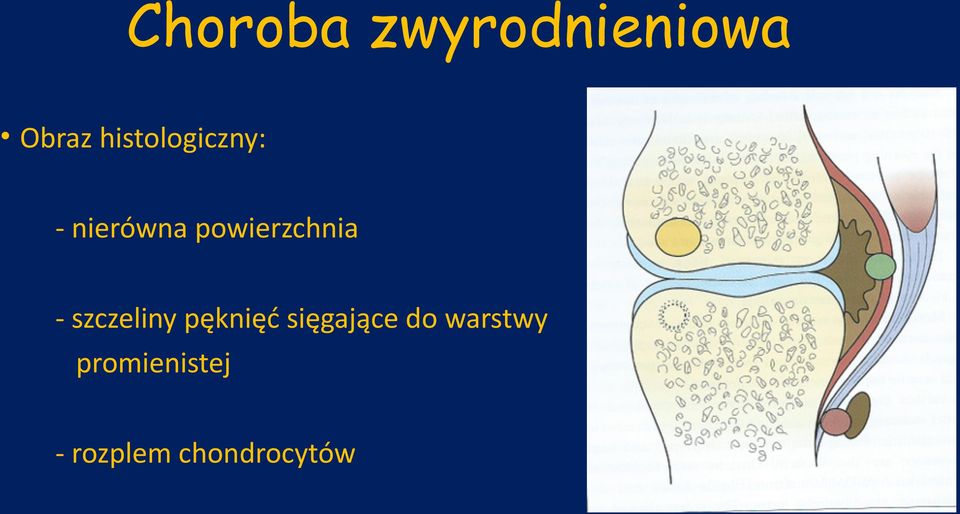 powierzchnia - szczeliny pęknięć