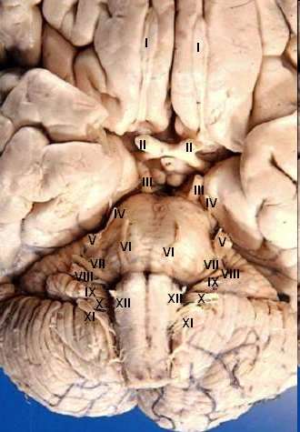 Nerwy czaszkowe I - nerw węchowy II - nerw wzrokowy III - nerw okoruchowy IV - nerw bloczkowy V - nerw trójdzielny VI - nerw odwodzący VII - nerw twarzowy Kolory: Biały czuciowe Czerwony ruchowe