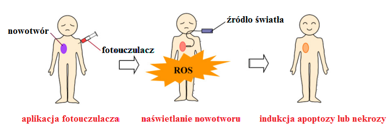 Terapia fotodynamiczna Terapia fotodynamiczna (ang. photodynamic therapy PDT) jest formą fotochemioterapii, która polega na aktywacji światłem leków fotouczulaczy.