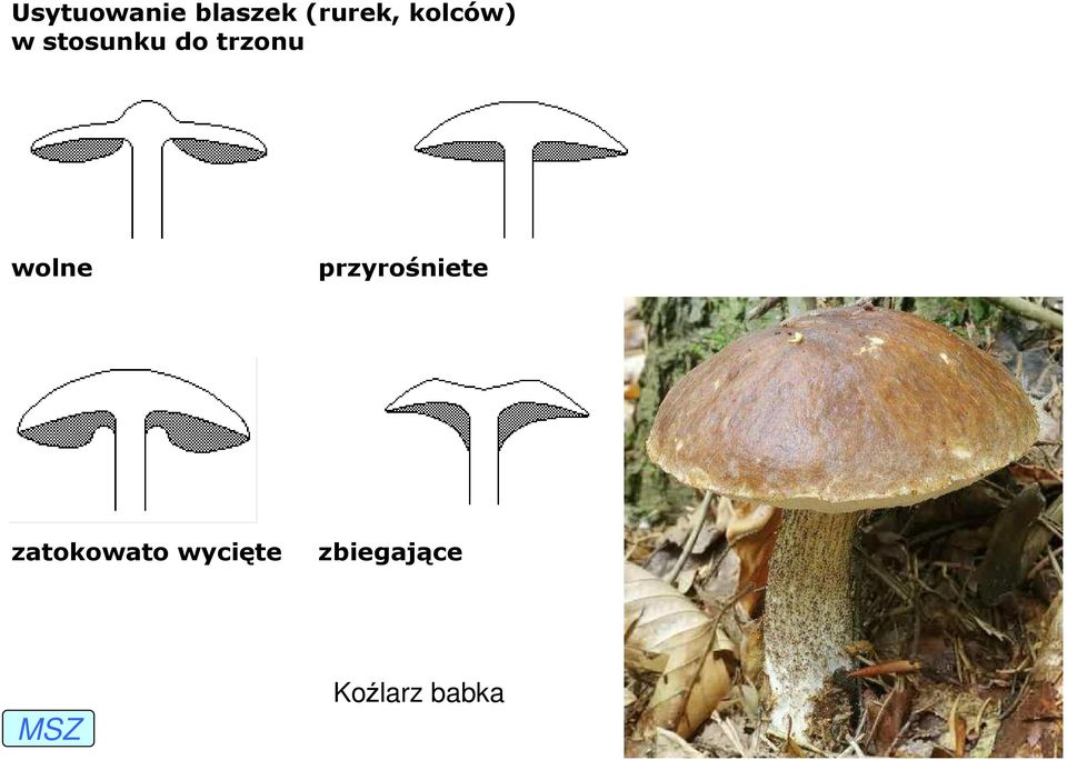 wolne przyrośniete zatokowato