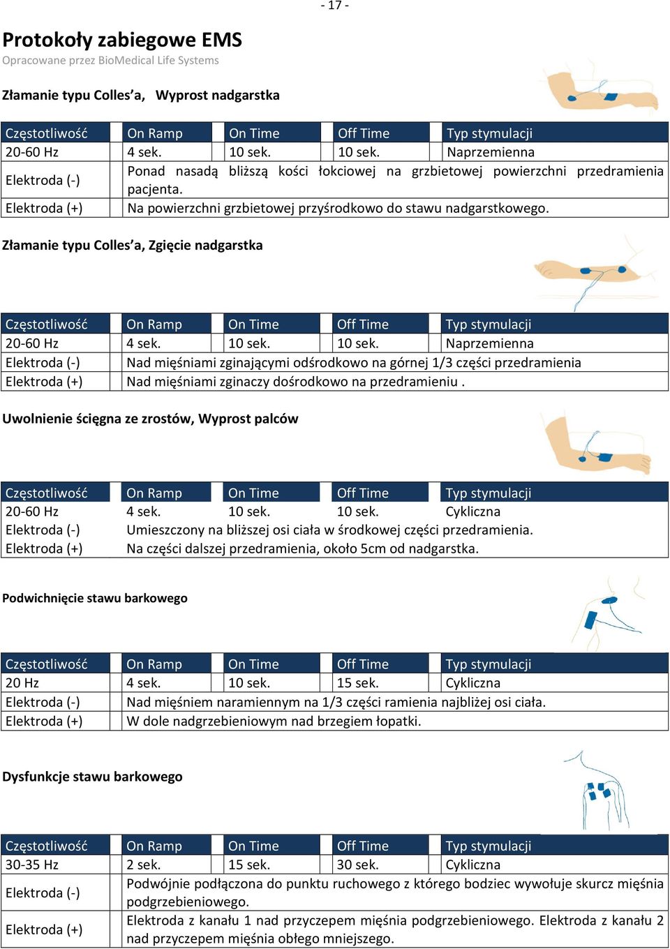 Elektroda (+) Na powierzchni grzbietowej przyśrodkowo do stawu nadgarstkowego. Złamanie typu Colles a, Zgięcie nadgarstka 20-60 Hz 4 sek. 10 sek.