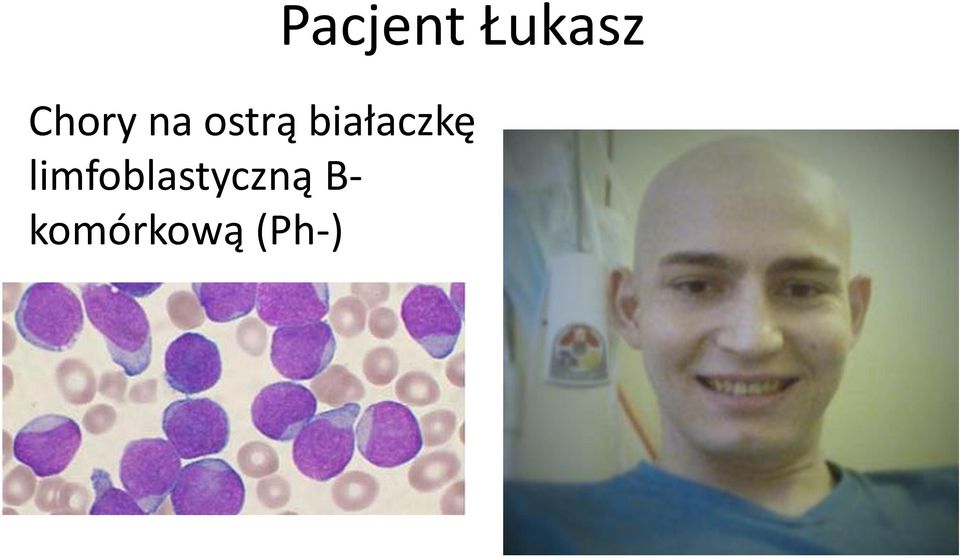 białaczkę