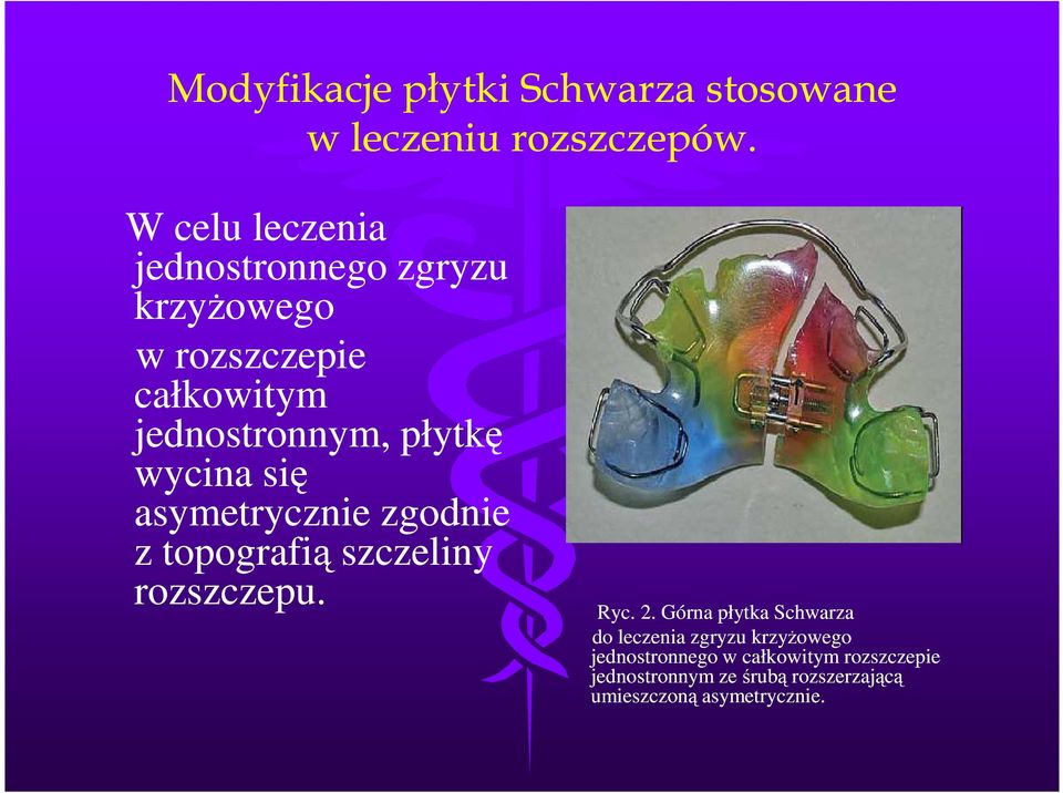 wycina się asymetrycznie zgodnie z topografią szczeliny rozszczepu. Ryc. 2.