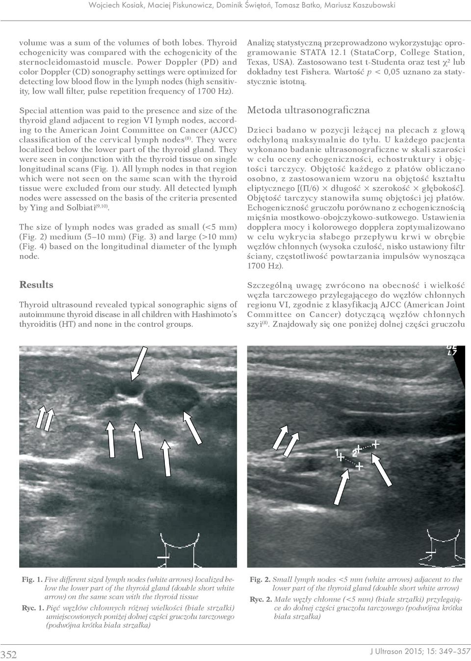 Power Doppler (PD) and color Doppler (CD) sonography settings were optimized for detecting low blood flow in the lymph nodes (high sensitivity, low wall filter, pulse repetition frequency of 1700 Hz).