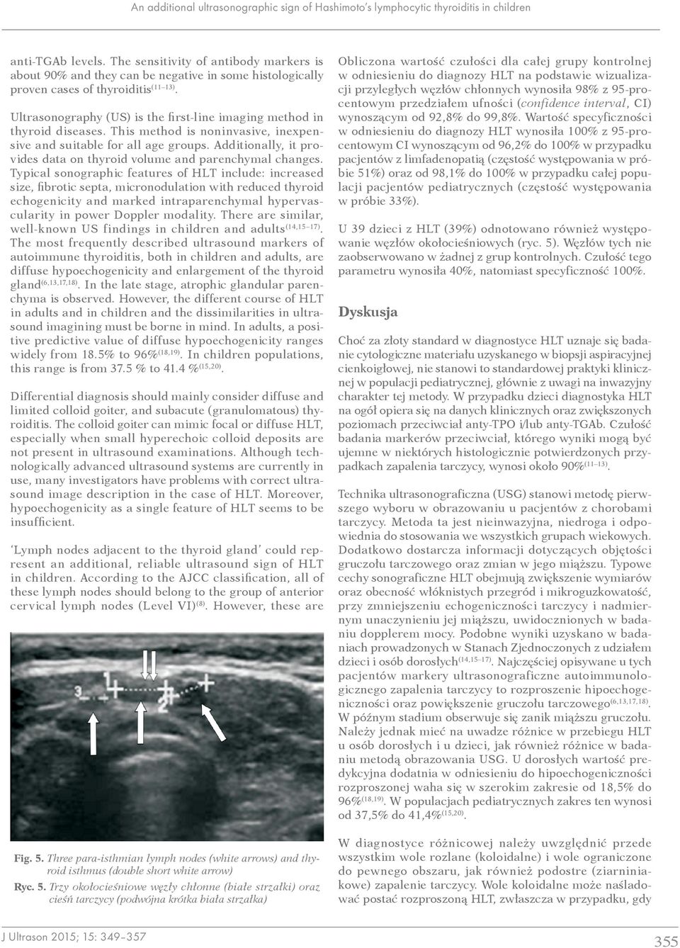 Ultrasonography (US) is the first-line imaging method in thyroid diseases. This method is noninvasive, inexpensive and suitable for all age groups.