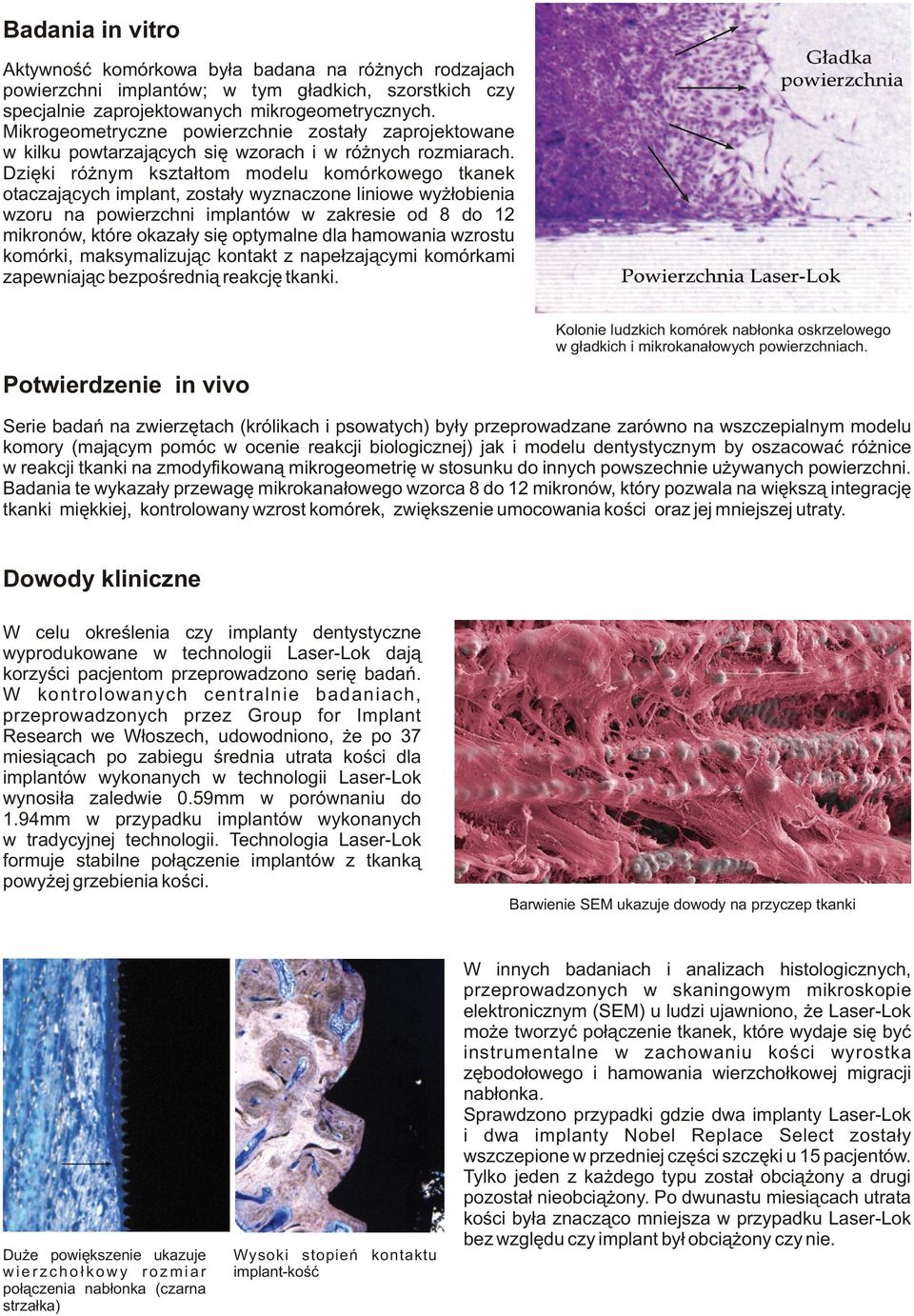 Dziêki ró nym kszta³tom modelu komórkowego tkanek otaczaj¹cych implant, zosta³y wyznaczone liniowe wy ³obienia wzoru na powierzchni implantów w zakresie od 8 do 12 mikronów, które okaza³y siê