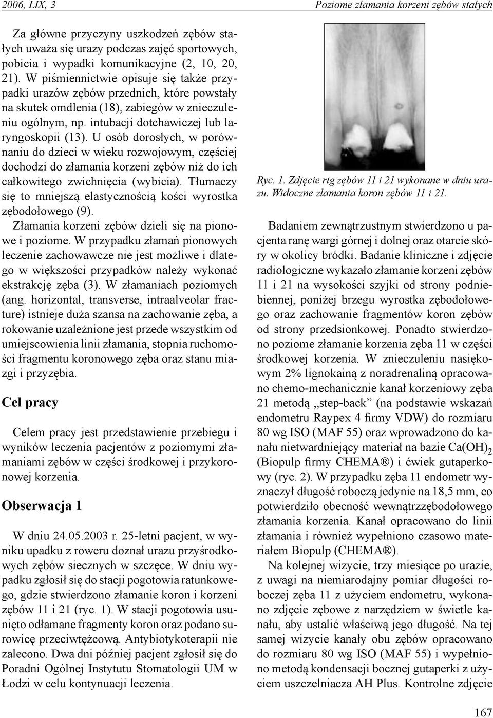 U osób dorosłych, w porównaniu do dzieci w wieku rozwojowym, częściej dochodzi do złamania korzeni zębów niż do ich całkowitego zwichnięcia (wybicia).